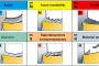 Aplicaciones de los medidores láser GLM 40 y GLM 30 de Bosch